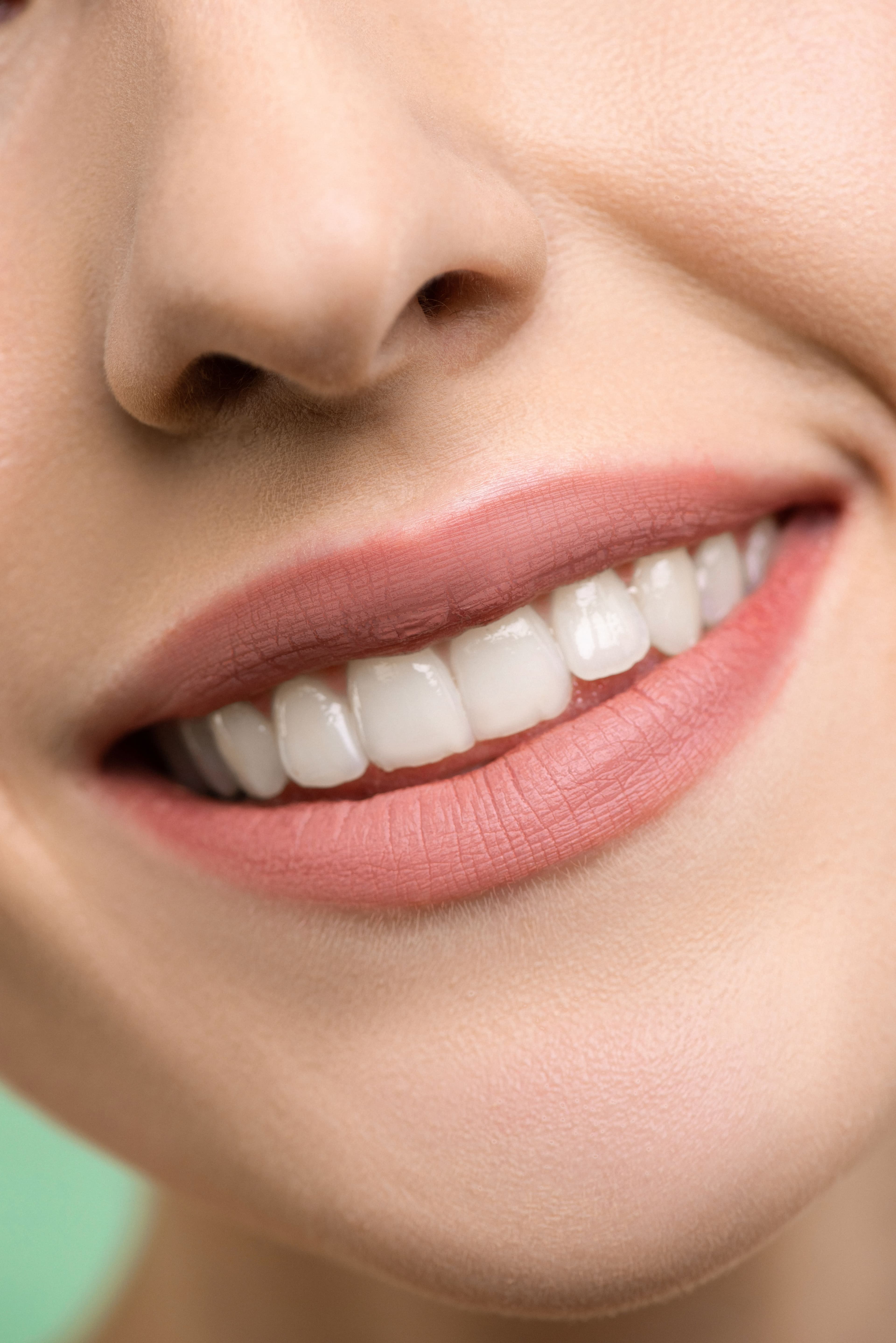 Lentes de Contato Dental