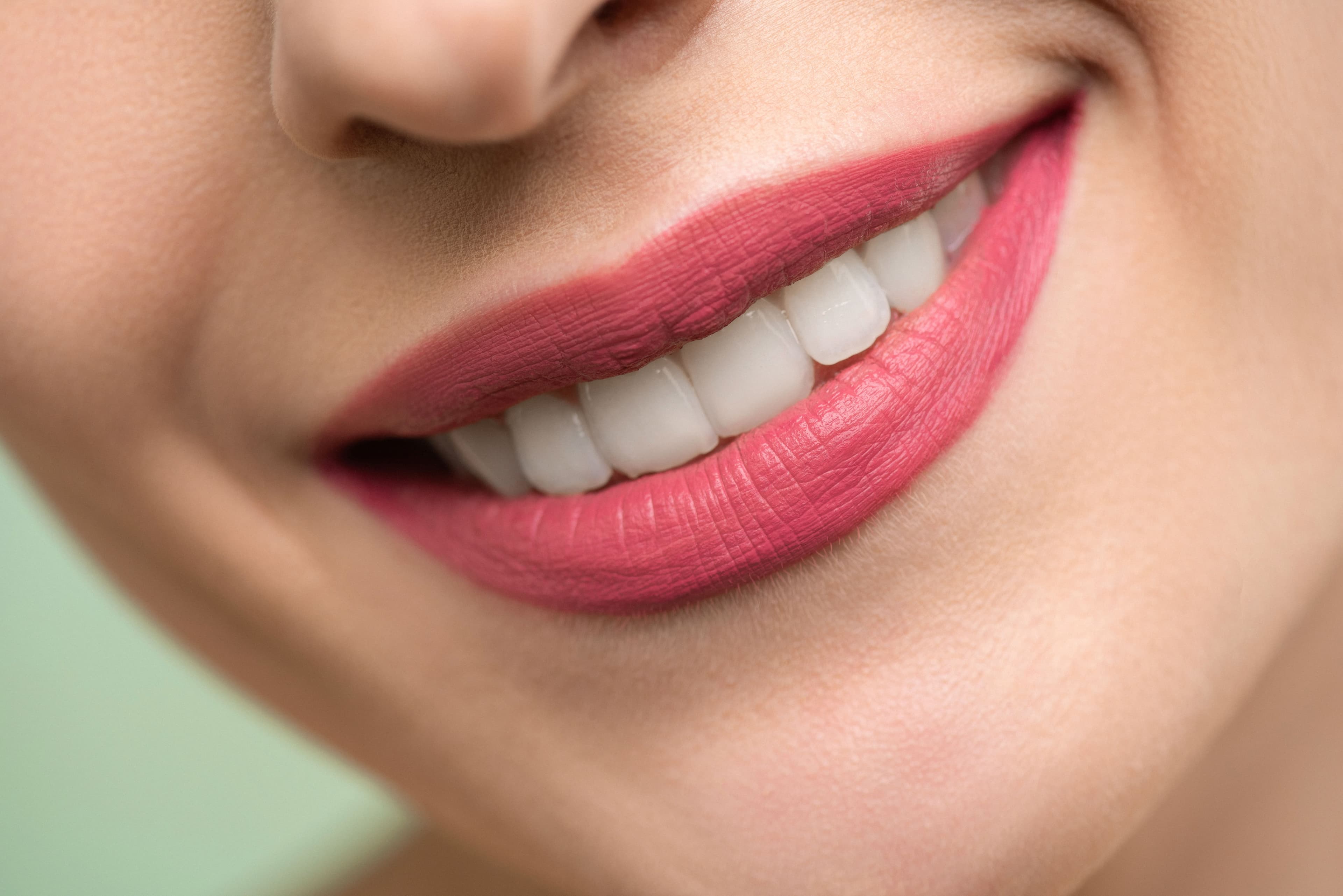 Sorriso com dentes perfeitamente alinhados após tratamento estético