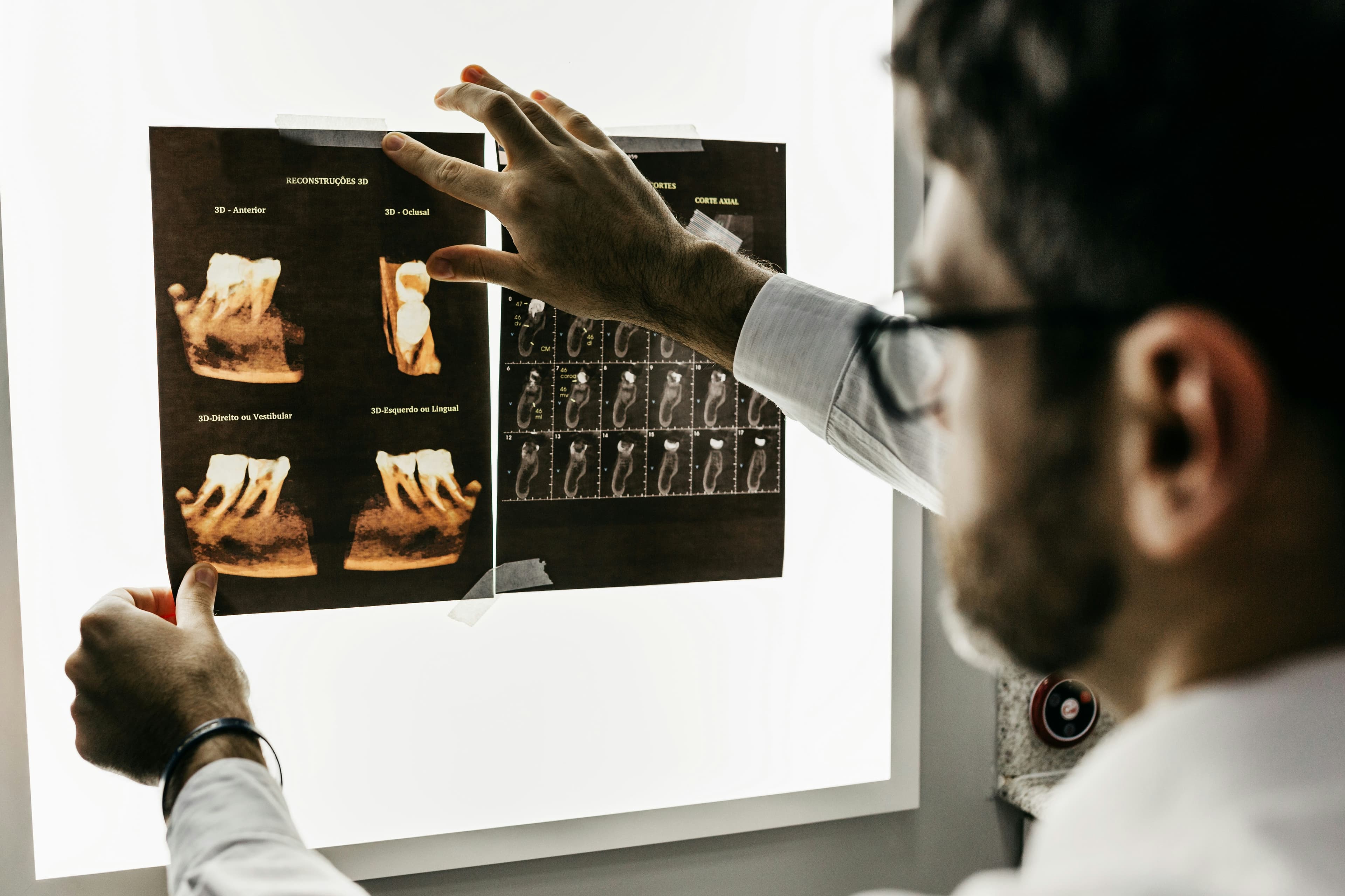 Com que frequência devo ir ao dentista? Guia de check-ups preventivos